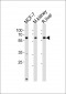 GCGR Antibody (Center)
